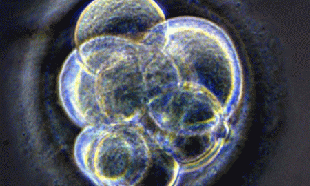 – 200805embryo1