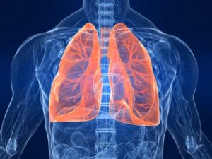 – 201107artificial lung