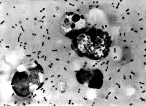 – 201110black plague bacteria