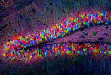 – 201203transgenic mouse hippocampus