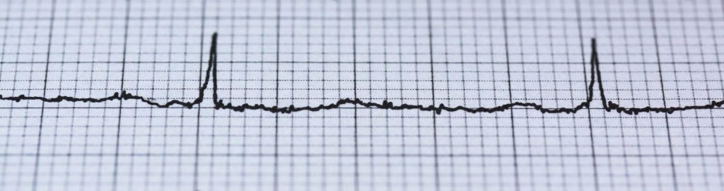 Heart attacks seem more common after extreme temperature changes