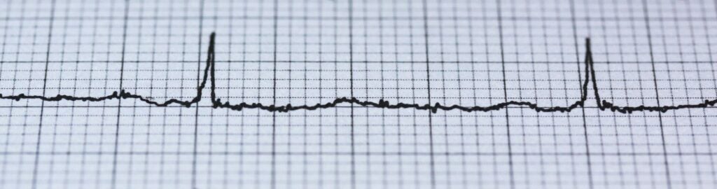 a heart monitor