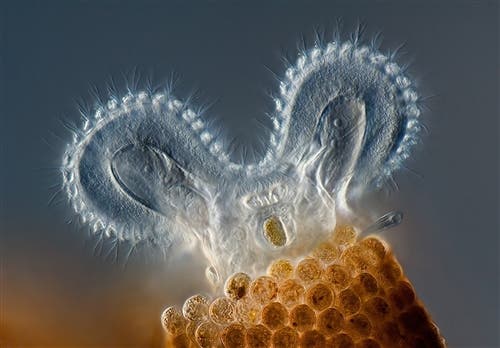 ss-111110-olmpus-bioscapes-winners-10.photoblog500 A rotifer impersonating Mickey Mouse. He's doing it right. (c) Charles Krebs
