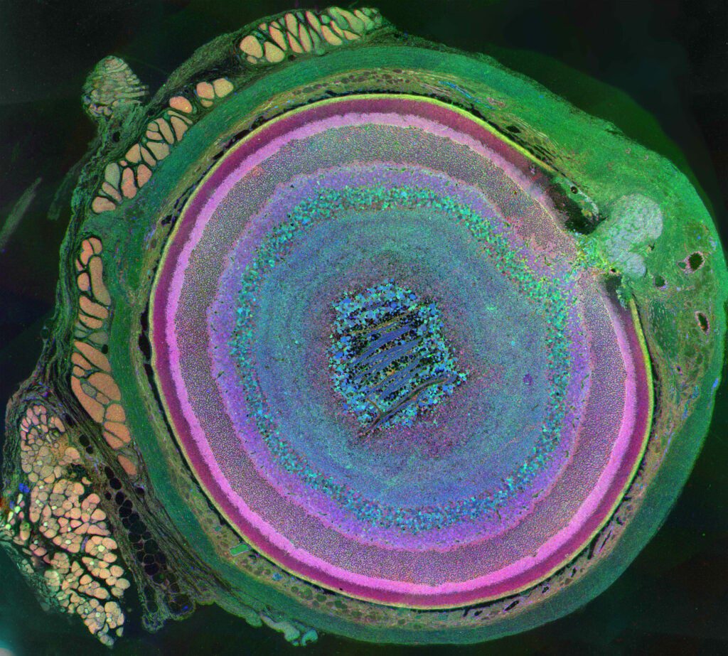 This is a metabolic snapshot of the diversity of cells in a mouse eye, and the first-place winner for photography in the 2011 International Science and Engineering Visualization Challenge. The image was derived using a technique called computational molecular phenotyping (CMP). The optic nerve head can be seen in the upper right portion of the image with the rectus muscles (red/gold) attaching to the sclera (green) on the upper left portion, and an oblique muscle in the lower left. Concentric rings of retinal layers are then represented from the sclera through to the vascular choroid to the optic fiber layer.