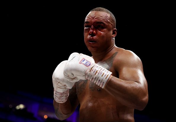 Wardley’s nose was a bloody mess by the end of the fight (Picture: Getty)
