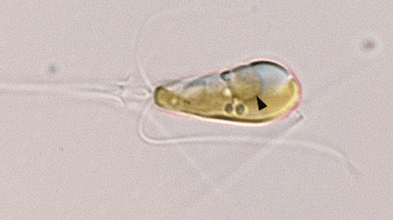 A light microscopy image shows the marine haptophyte algae Braarudosphaera bigelowii with a black arrow pointing to the nitroplast organelle. (Photo credit: Tyler Coale)
