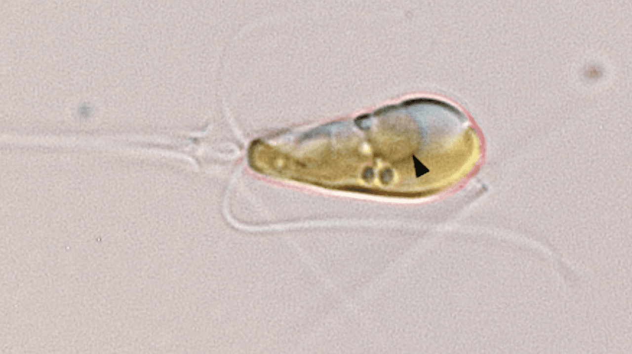 A light microscopy image shows the marine haptophyte algae Braarudosphaera bigelowii with a black arrow pointing to the nitroplast organelle. (Photo credit: Tyler Coale)