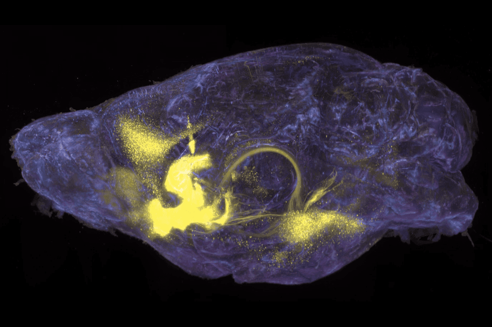 Brain-wide mapping of drug-activated neurons that project to a mouse’s nucleus accumbens. Credit: Rockefeller University.